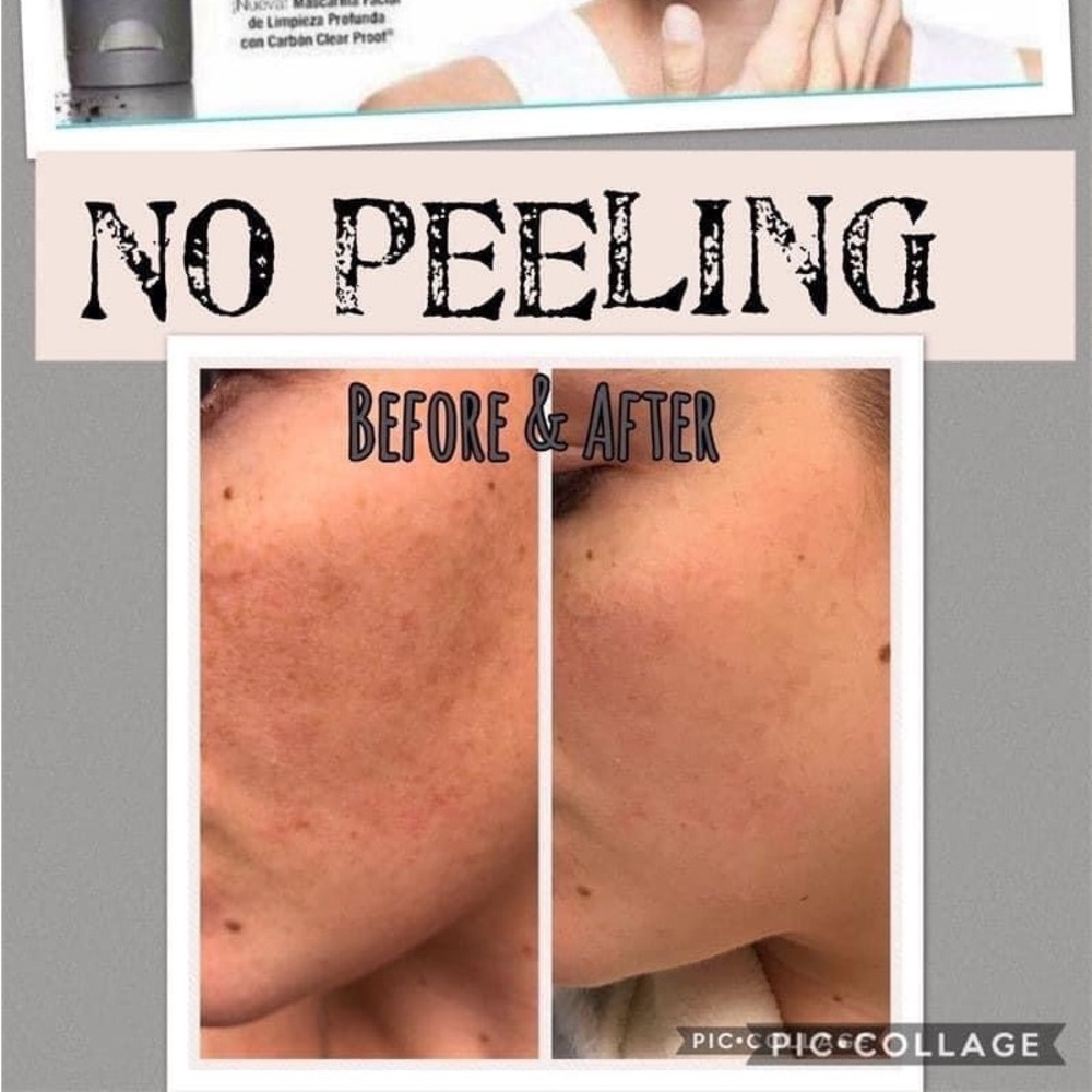 Mary Kay charcoal face mask